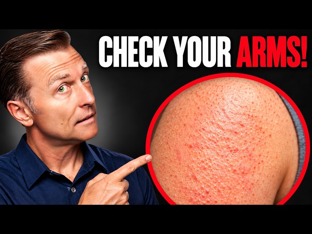 The One Deficiency Behind Dry Eyes, Dry Mouth, and Bumpy Arms