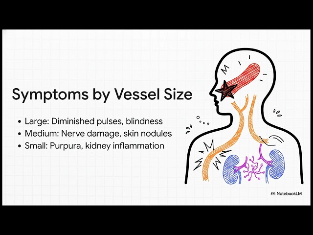 Vasculitis Explained: Causes and Facts