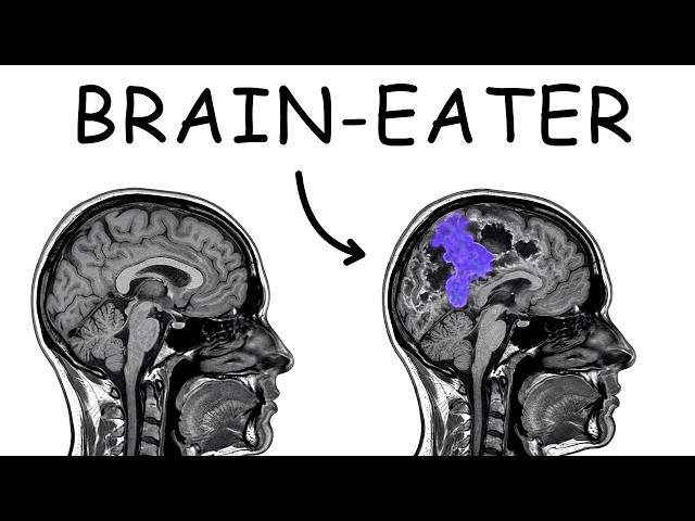 What Getting Killed by a Brain Eating Amoeba Feels Like