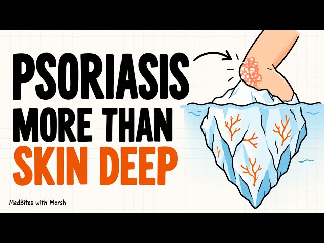 Psoriasis Explained: Symptoms, Triggers & Why It’s More Than Skin Deep