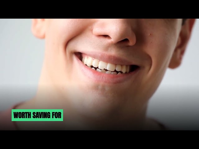 Every Looksmaxxing Method, Ranked by What It Actually Costs